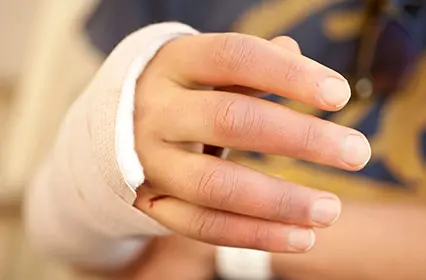 Patient's hand bandaged and in a cast